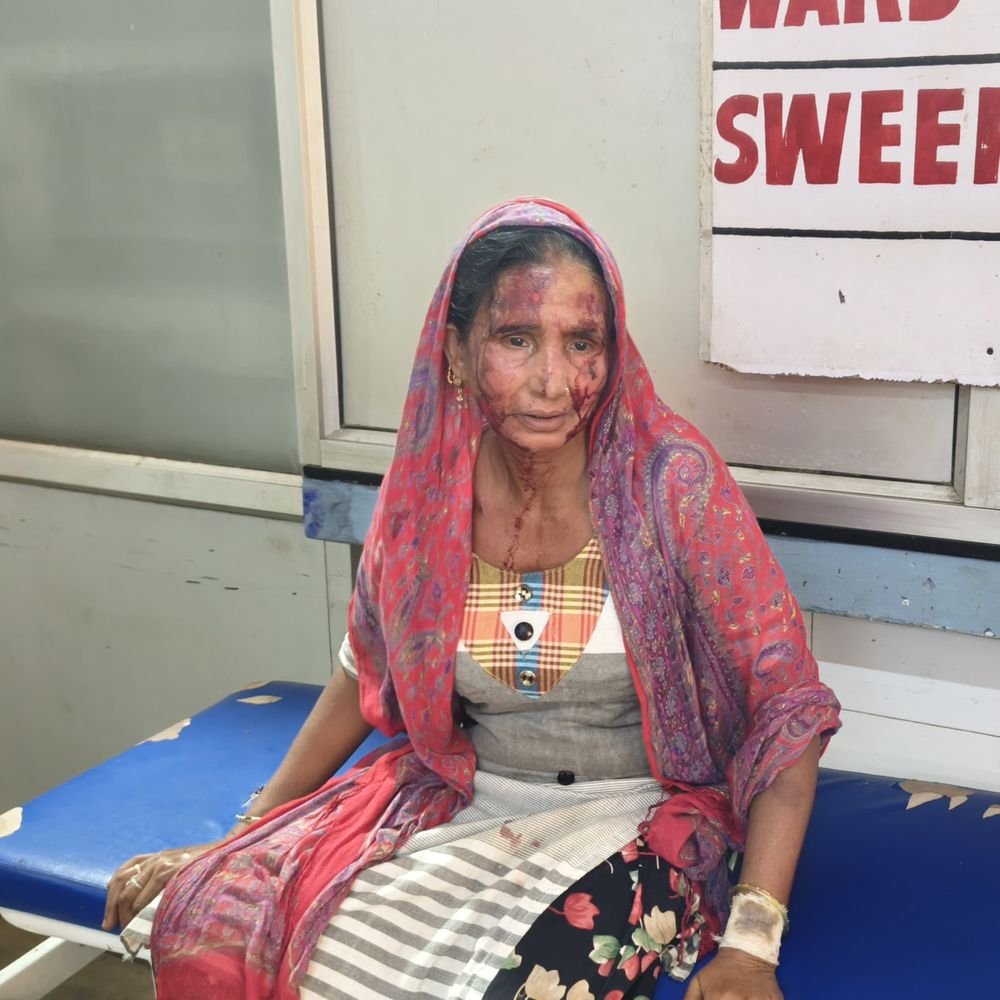 संभल में सिलेंडर मांगने पर बहू ने सास को पीटा:विवाद के बाद सास घायल, थाने में बहू के खिलाफ दी तहरीर