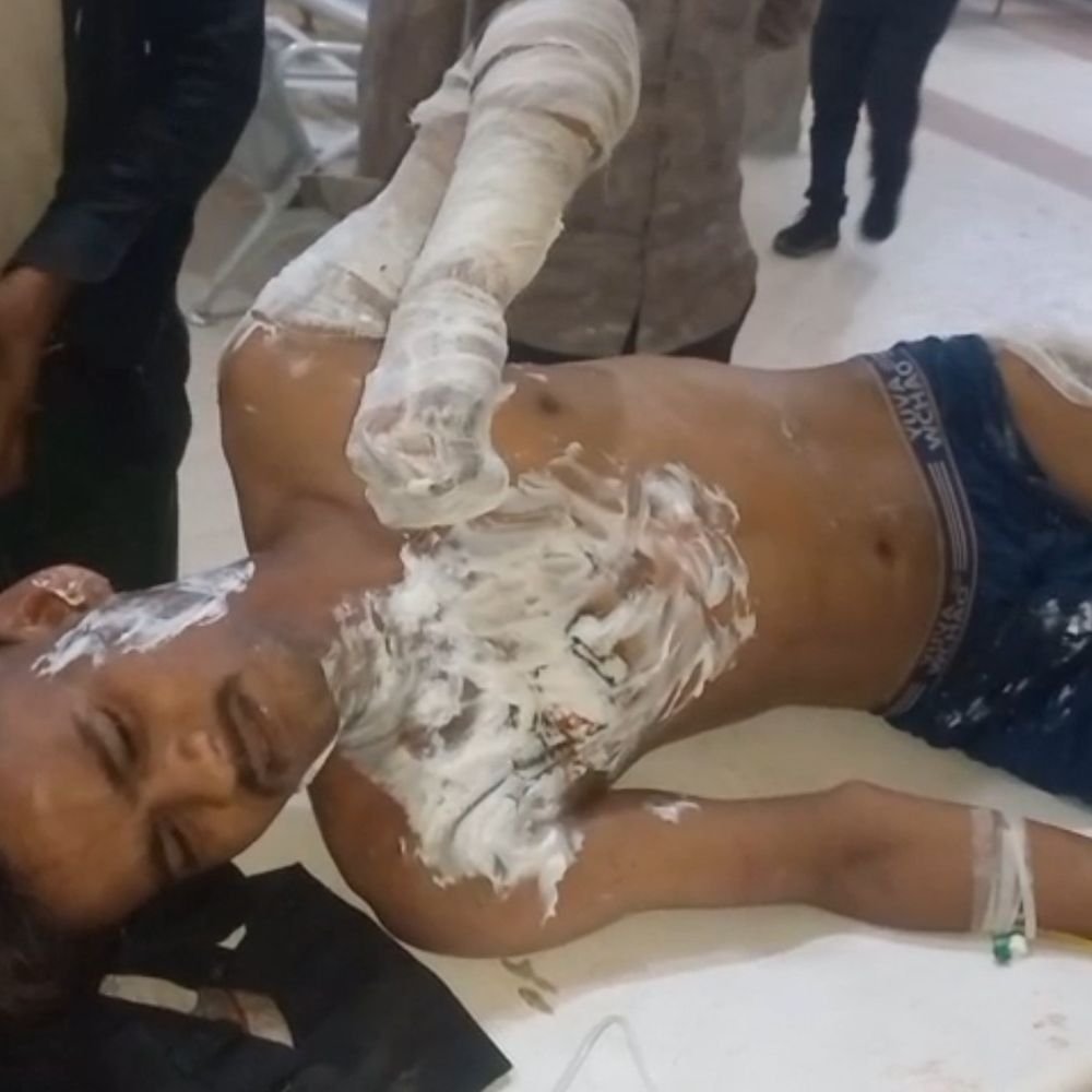 माता के भवन में झालर लगाते समय लगा करंट:24 वर्षीय युवक झुलसा, भाई बोला- बिजली का काम करने निकला था; ट्रॉमा सेंटर में भर्ती