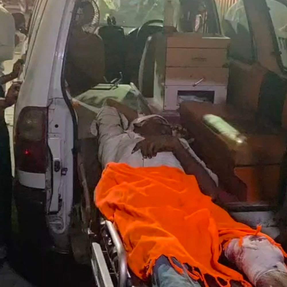 स्कूटी-बाइक की आमने-सामने भिड़ंत, 5 घायल:टक्कर इतनी तेज थी कि दोनों वाहनों के परखच्चे उड़े; एक गंभीर