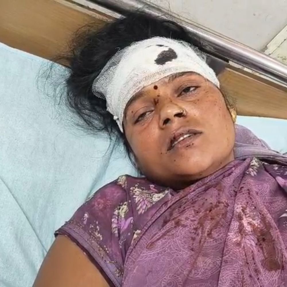 फिरोजाबाद में बात न करने पर फोड़ा महिला का सिर:SP कार्यालय में 3 के खिलाफ की शिकायत, जबरदस्ती बात करने के लिए बनाते हैं दबाव
