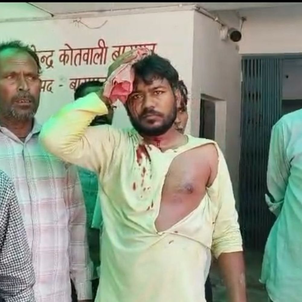 बागपत में नगरपालिका कर्मचारी पर लोहे के पाइप से हमला:सिर में गंभीर चोट, पुलिस ने 4 लोगों पर केस दर्ज कर तलाश शुरू की