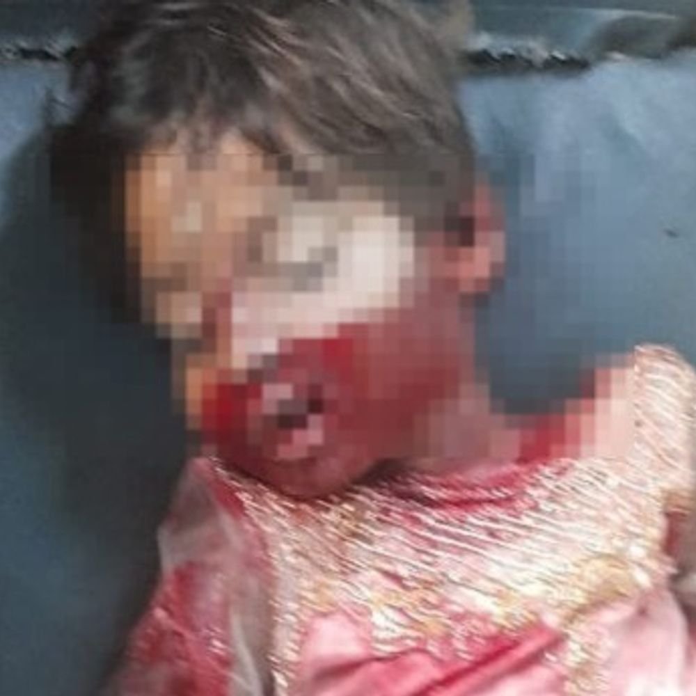 फतेहपुर में स्कूल बस ने बच्ची को रौंदा, मौत:सड़क किनारे खड़ी थी बच्ची , हादसे के बाद चालक फरार
