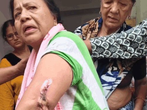 मेरठ में 11000 वोल्ट लाइन की चपेट में आई महिला:परिजन बोले- कई बार शिकायत के बाद भी लाइन नहीं हटाई