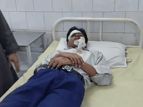 गाजियाबाद में तेज रफ्तार क्रेटा की टक्कर से 3 घायल:कलेक्ट्रेट रोड पर सेठ मुकंदलाल के सामने हुआ एक्सीडेंट, बाइक के परखच्चे उड़े
