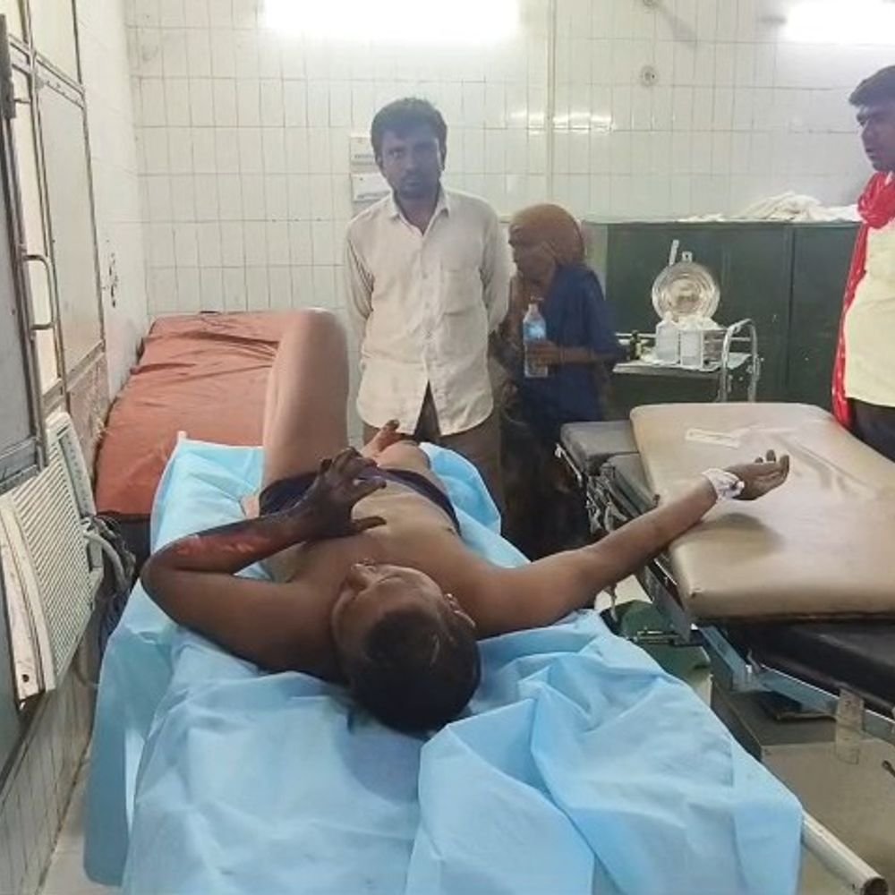 महोबा में जलते चूल्हे में गिरकर युवक झुलसा:घर से भागकर नाले में कूदा, हालत गंभीर होने पर हायर सेंटर रेफर