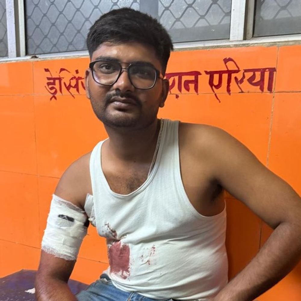 लखनऊ फास्ट फूड खा रहा युवक अचानक हुआ घायल:गोली और पटाखे में उलझी पुलिस, ट्रामा सेंटर रेफर