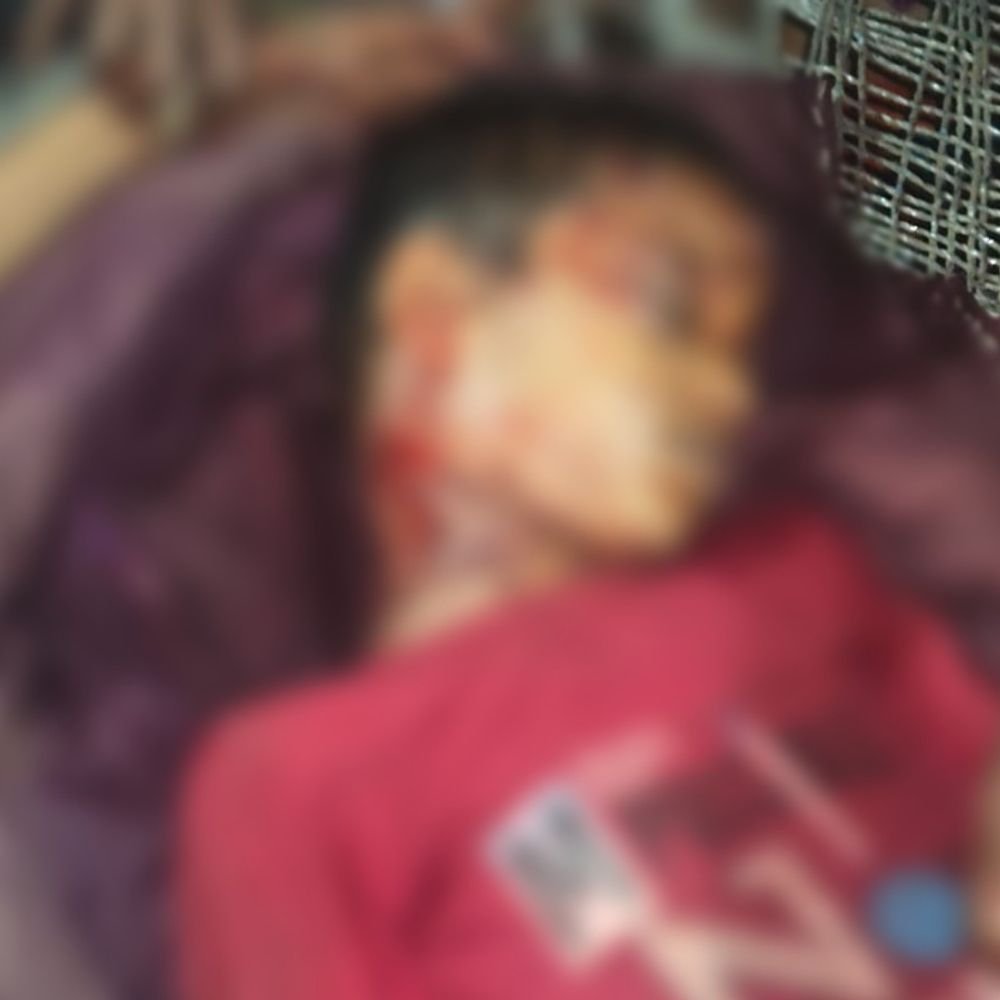 बहराइच में तेंदुए के हमले से बच्चे की मौत:घर के पीछे खड़ा था मासूम, चीख सुनकर लाठी-डंडे लेकर दौड़े ग्रामीण