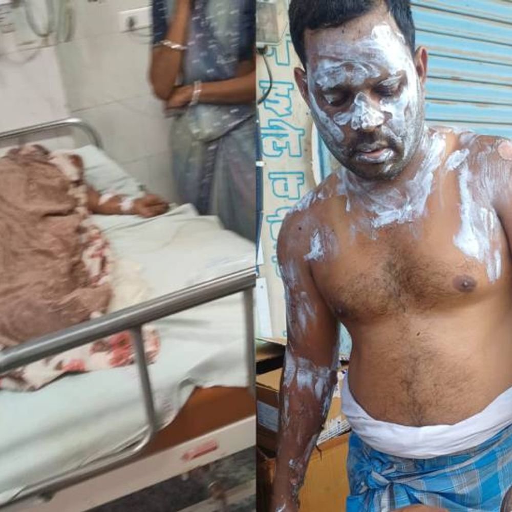 गोरखपुर में लाइटर जलाते ही लगी घर में आग:4 झुलसे, घरेलू सिलेंडर चेक करते समय हादसा हुआ, कमरे में फैल गई थी गैस