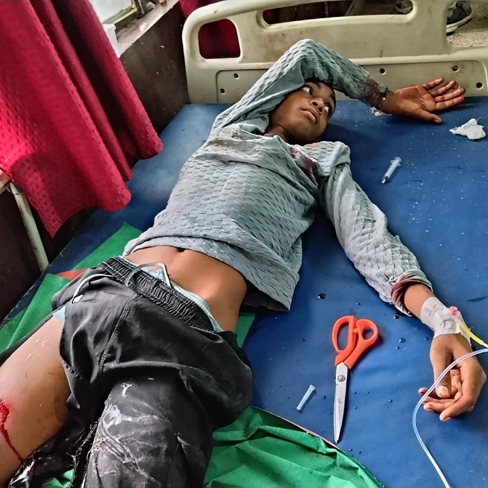 लखीमपुर-खीरी में ऑटो- स्कूटी की टक्कर, तीन युवक गंभीर घायल:प्राथमिक उपचार के बाद शाहजहांपुर रेफर, ऑटो चालक फरार