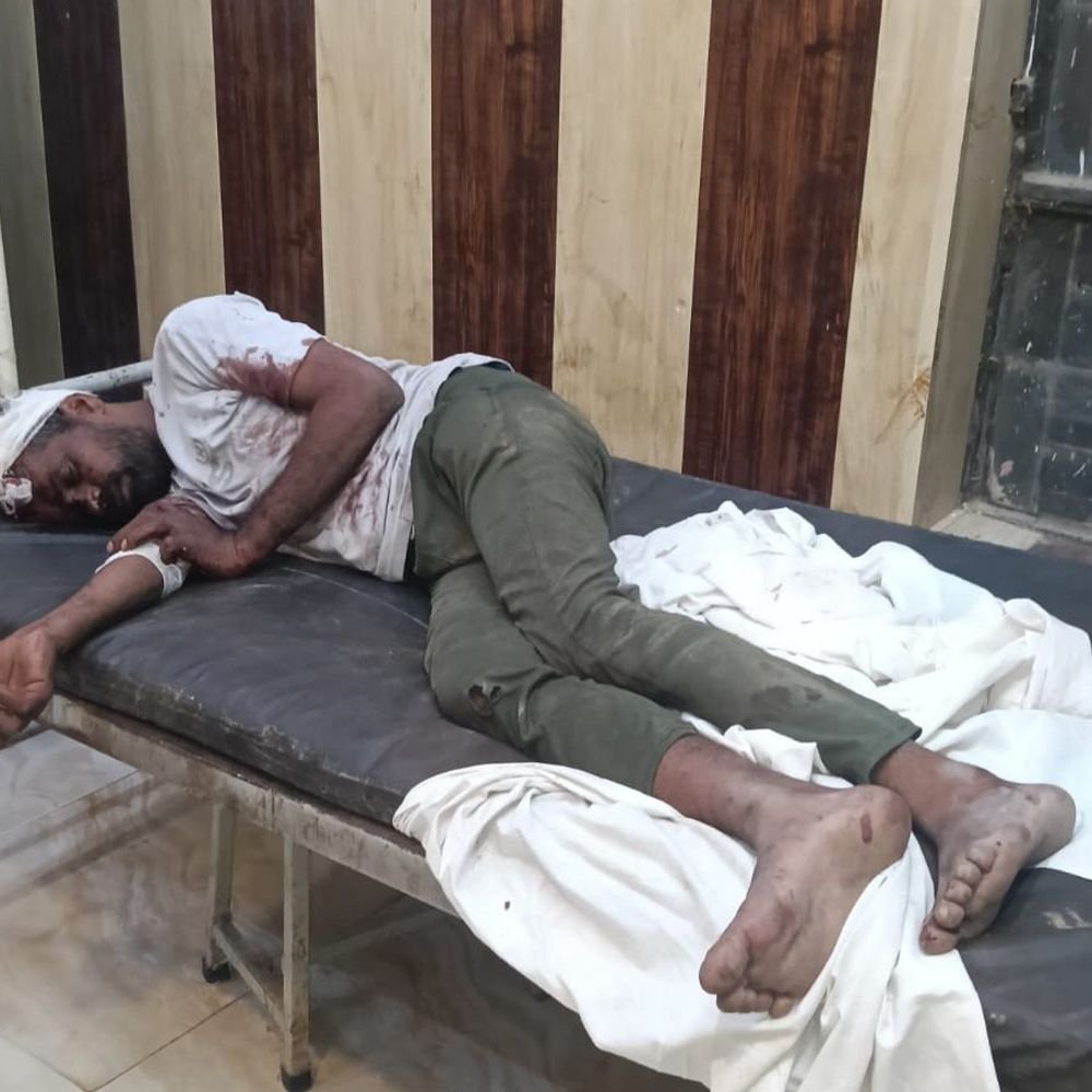डंपर ने बाइक सवार दो युवकों को टक्कर मारी:एक की हालत नाजुक, ट्रॉमा सेंटर रेफर; दूसरे का सीएचसी में इलाज जारी