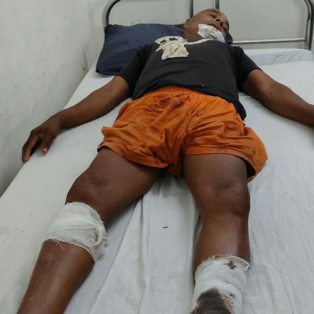 मछली पकड़ने के विवाद में किसान पर धारदार-हथियार से हमला:महराजगंज में हालत गंभीर, पिता को बचाने पहुंचे बेटे को भी चोटें आईं