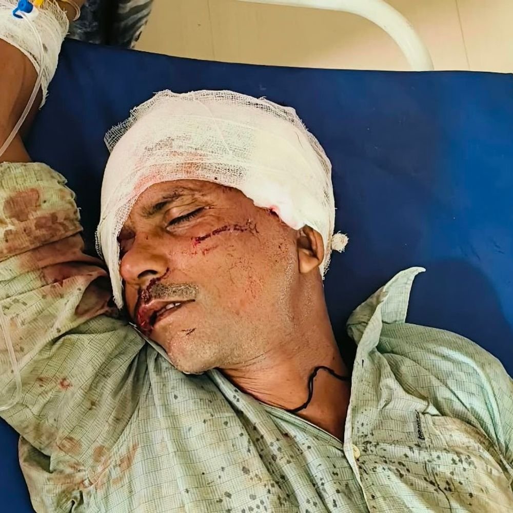 कानपुर में ट्रक की टक्कर से एक की मौत:गंभीर हालत में दूसरा जिला अस्पताल रेफर, परिजनों में शोक का माहौल