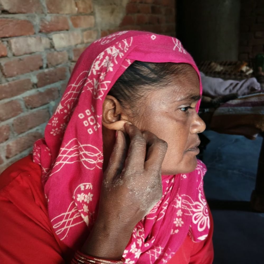 दिव्यांग दंपती से बाइक सवारों ने कुंडल लूटे:40 हजार की बाली पेंशन जोड़कर खरीदी थी; पति के साथ लकड़ी लेने गई थी