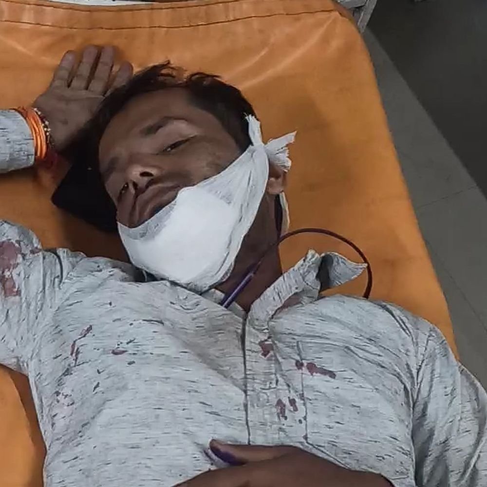 कानपुर फ्लाईओवर पर ट्रक में घुसी बाइक, युवक गंभीर घायल:नौकरी तलाश कर लौट रहा था फतेहपुर, जबड़े में चोट आई