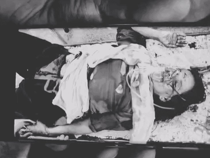 गोरखपुर में पत्नी पर हंसिया से हमला, हालत गंभीर:अवैध संबंध के शक में सिर और गर्दन पर किया वार, पति गिरफ्तार