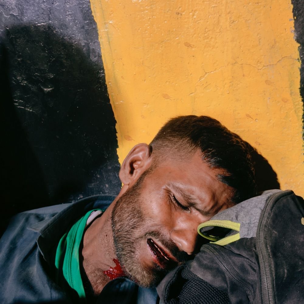 मुरादाबाद में सोनकपुर पुल से नीचे गिरा युवक:रोड क्रॉस करने की कोशिश में पुल के गैप से नीचे रेल ट्रैक पर गिरा