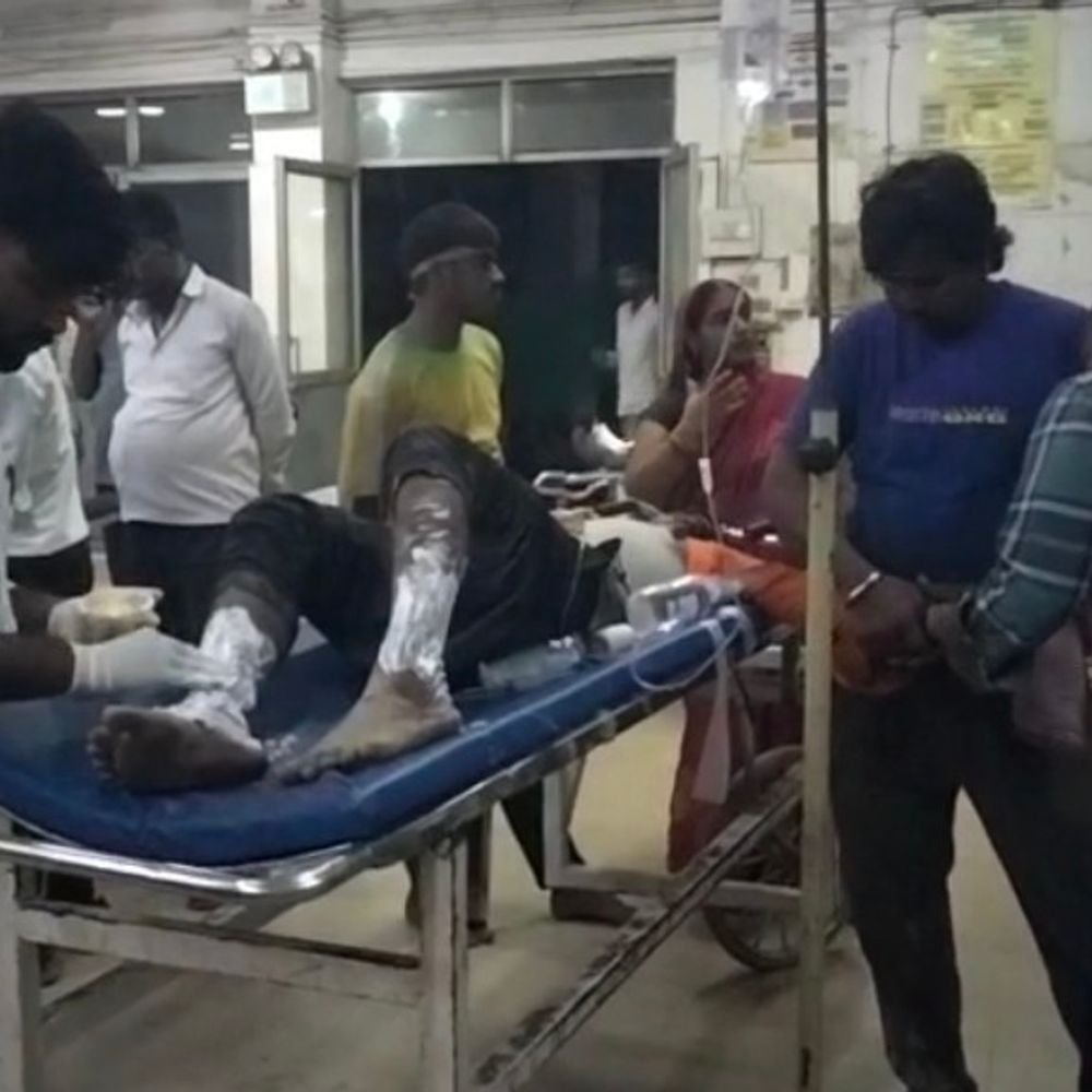 मूर्ति विसर्जन के लिए जाते समय जनरेटर में आग लगी:सुल्तानपुर में 16 साल का किशोर झुलसा, मेडिकल कॉलेज में इलाज जारी
