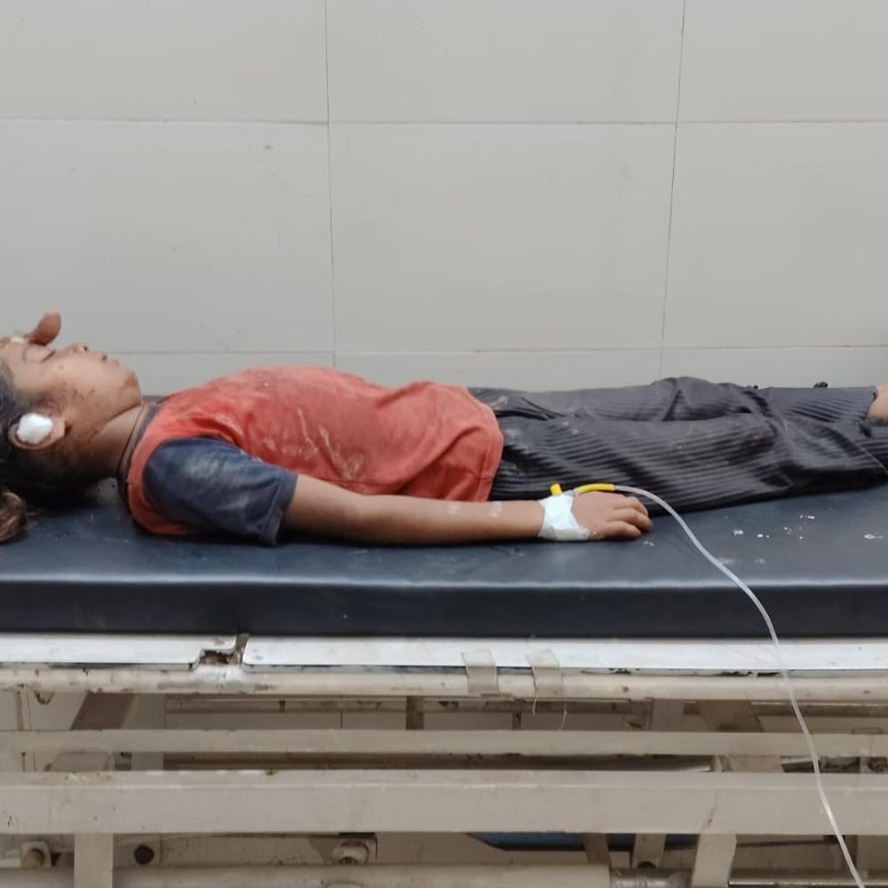 मोटरसाइकिल की ठोकर से बच्ची गंभीर रूप से घायल:महाराजगंज के जरा अस्पताल से गोरखपुर मेडिकल कॉलेज रेफर