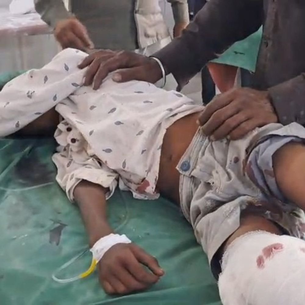 डंपर ने सब्जी ठेले को रौंदा, मां-बेटे समेत 4 घायल:महोबा में कानपुर-सागर हाईवे पर डाक बंगला मैदान के पास हादसा, मासूम गंभीर