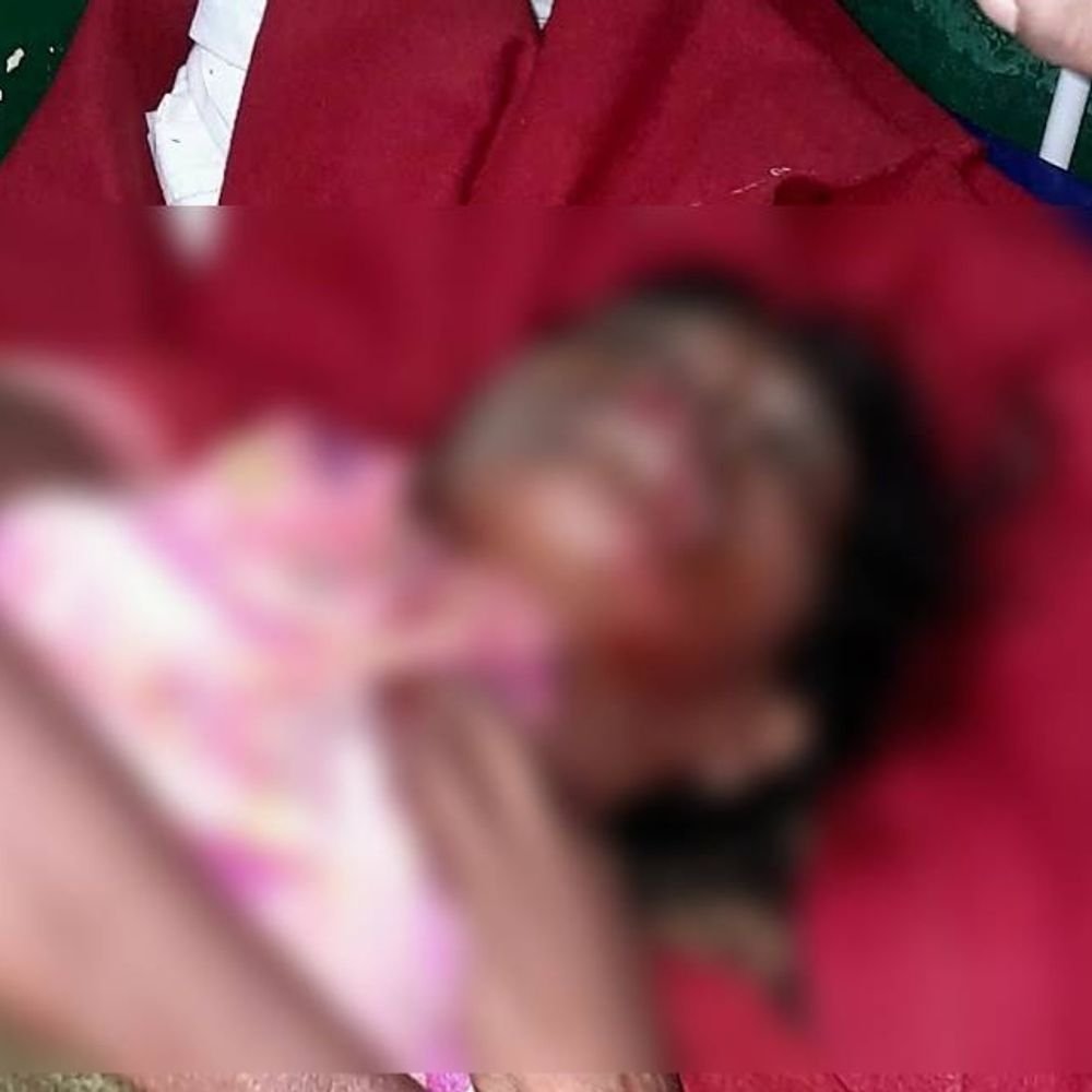 लखीमपुर में जंगली जानवर के हमले से महिला घायल:गंभीर हालत में लखनऊ रेफर, वन विभाग को तेंदुए के पैरों के मिले निशान