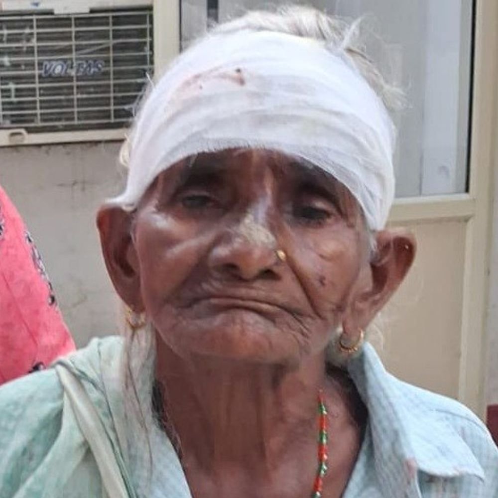 ग्रेटर नोएडा में 80 साल की महिला का सिर फोड़ा:चारे में आग लगाने का विरोध करने पर हमला किया, आरोपी फरार