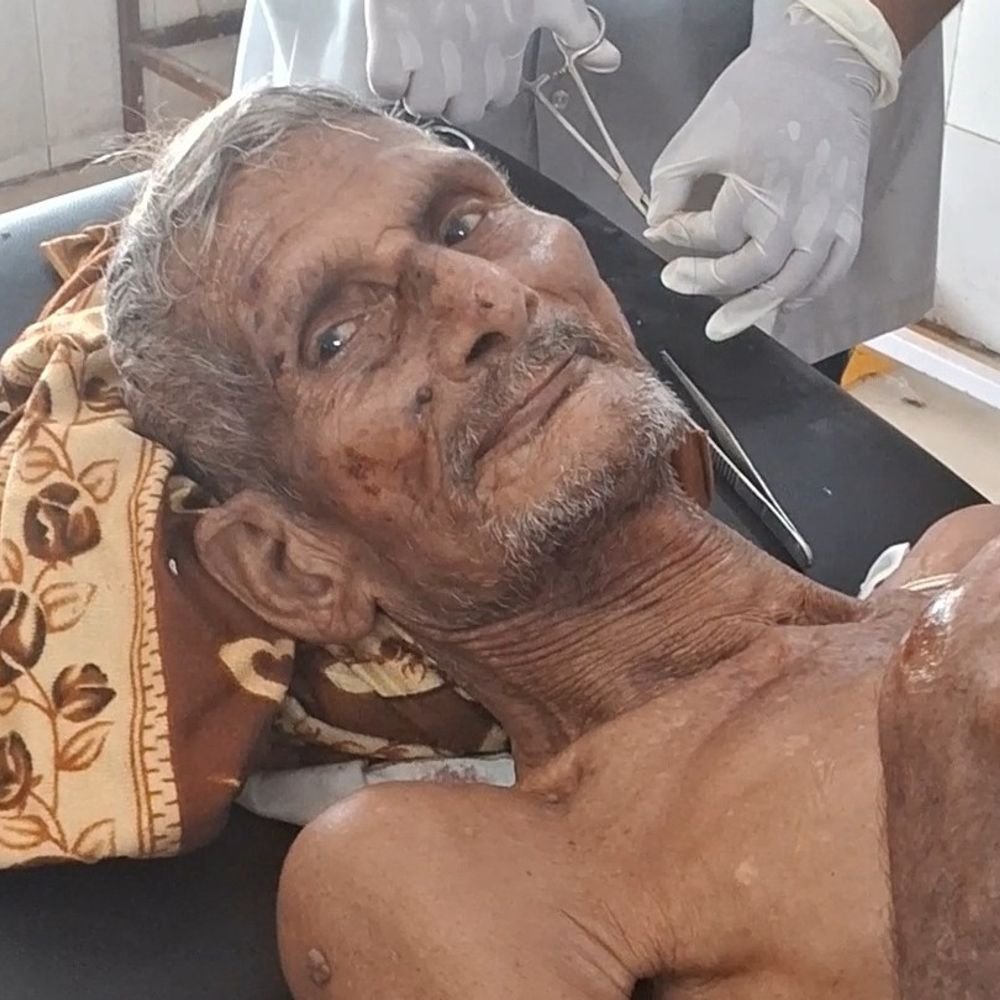 चारपाई पर लेटे 85 वर्षीय बुजुर्ग पर सांड का हमला:इटावा में चारपाई समेत रौंदा, गंभीर हालत में अस्पताल रेफर