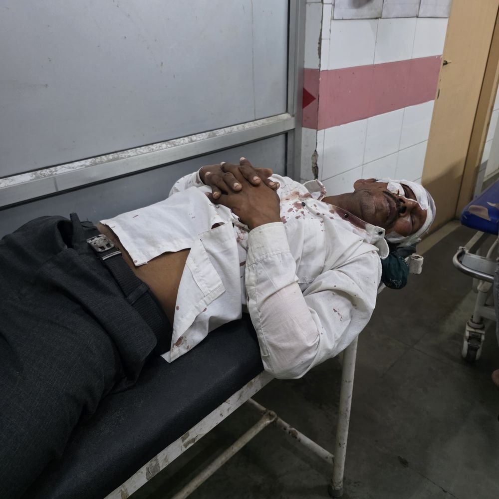 मकान के बंटवारे पर मारपीट, चार लोग घायल:संभल में हुआ विवाद, लंबे समय से चल रहा था विवाद