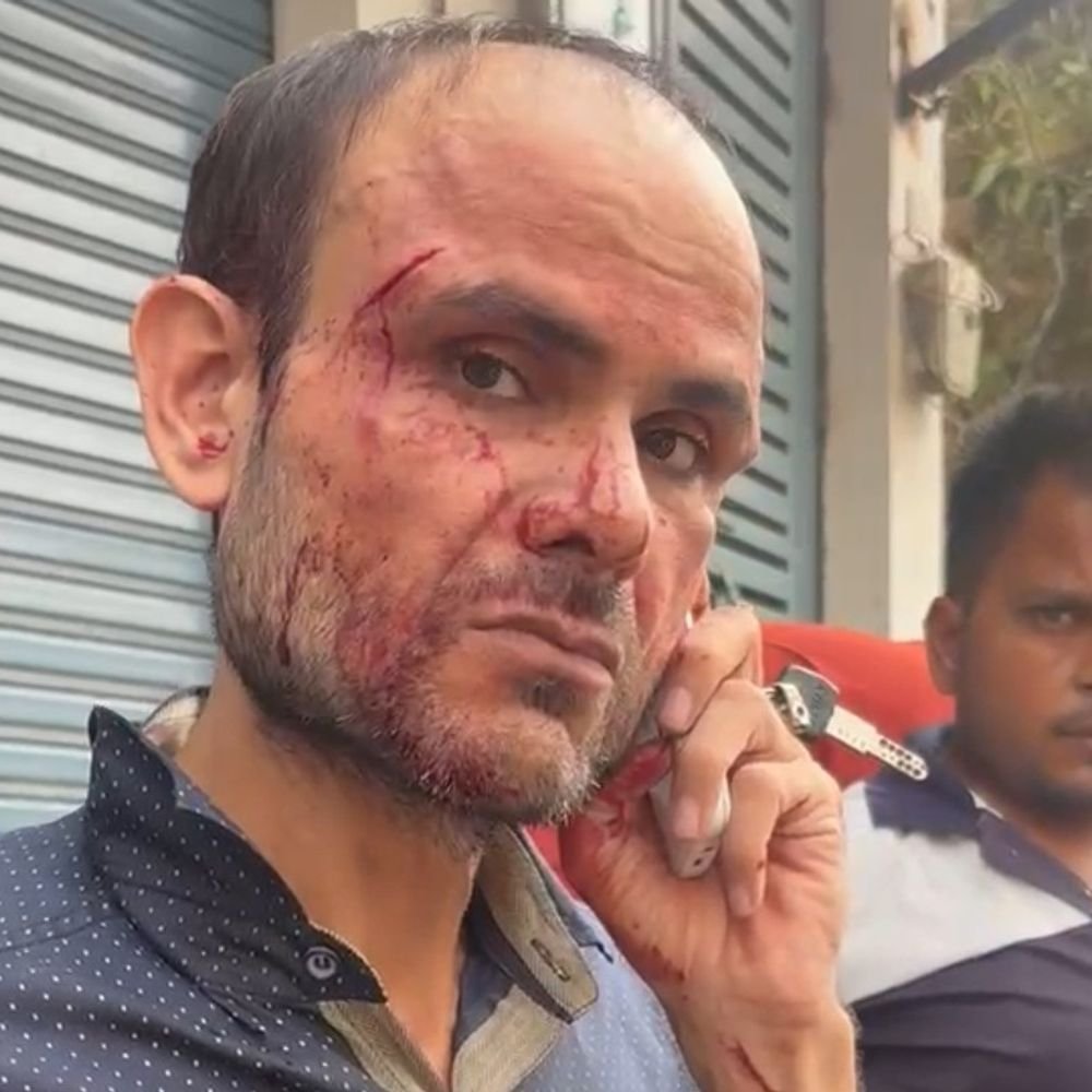 छात्र को थप्पड़ मारा तो साथियों संग शिक्षक को पीटा:बुलंदशहर के कॉलेज जाते समय बस स्टैंड पर किया हमला, बुलंदशहर रेफर