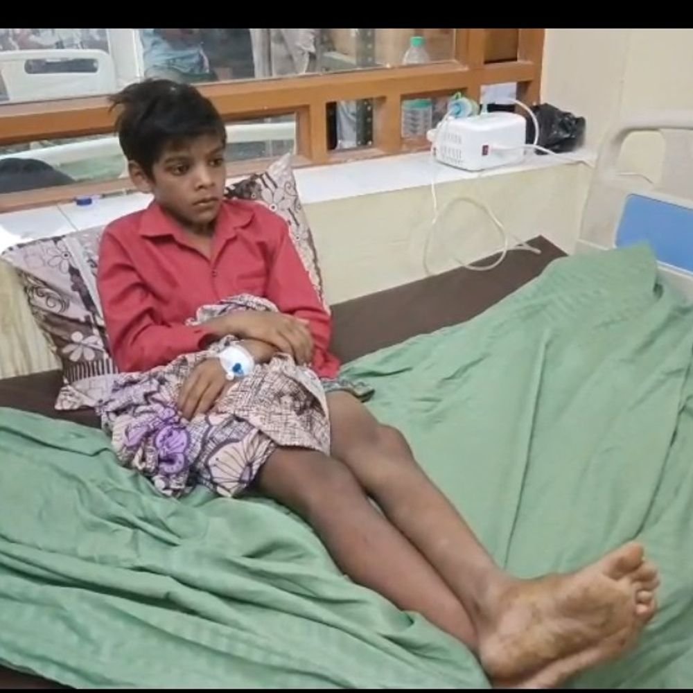 हाथरस में पांच लोगों को सांप ने डंसा:बोतल में बंद सांप को जिला अस्पताल में लेकर पहुंचे लोग