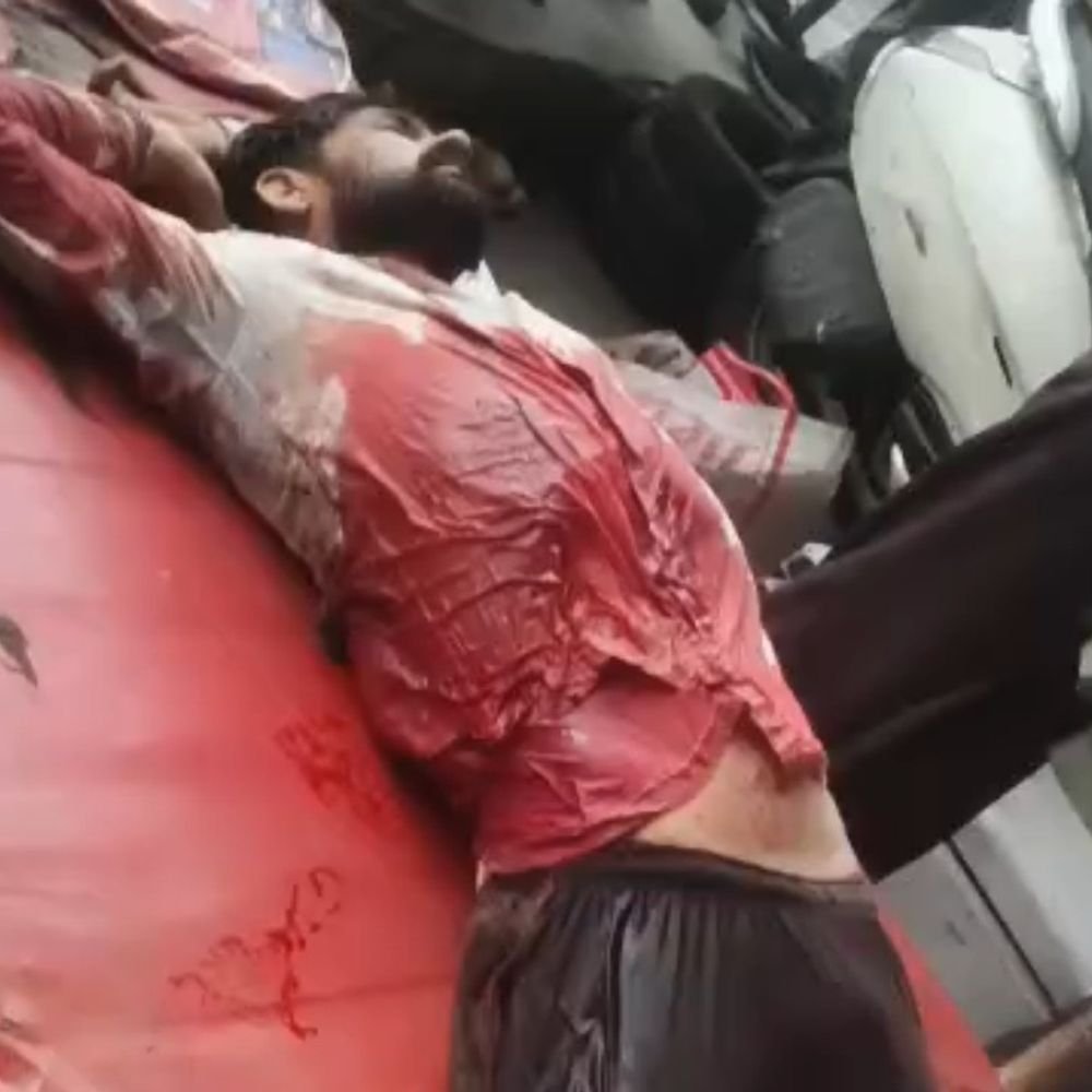लखनऊ के अलीगंज में दिन दहाड़े चाकूबाजी:युवक की हालत गंभीर, शरीर पर किए कई वार