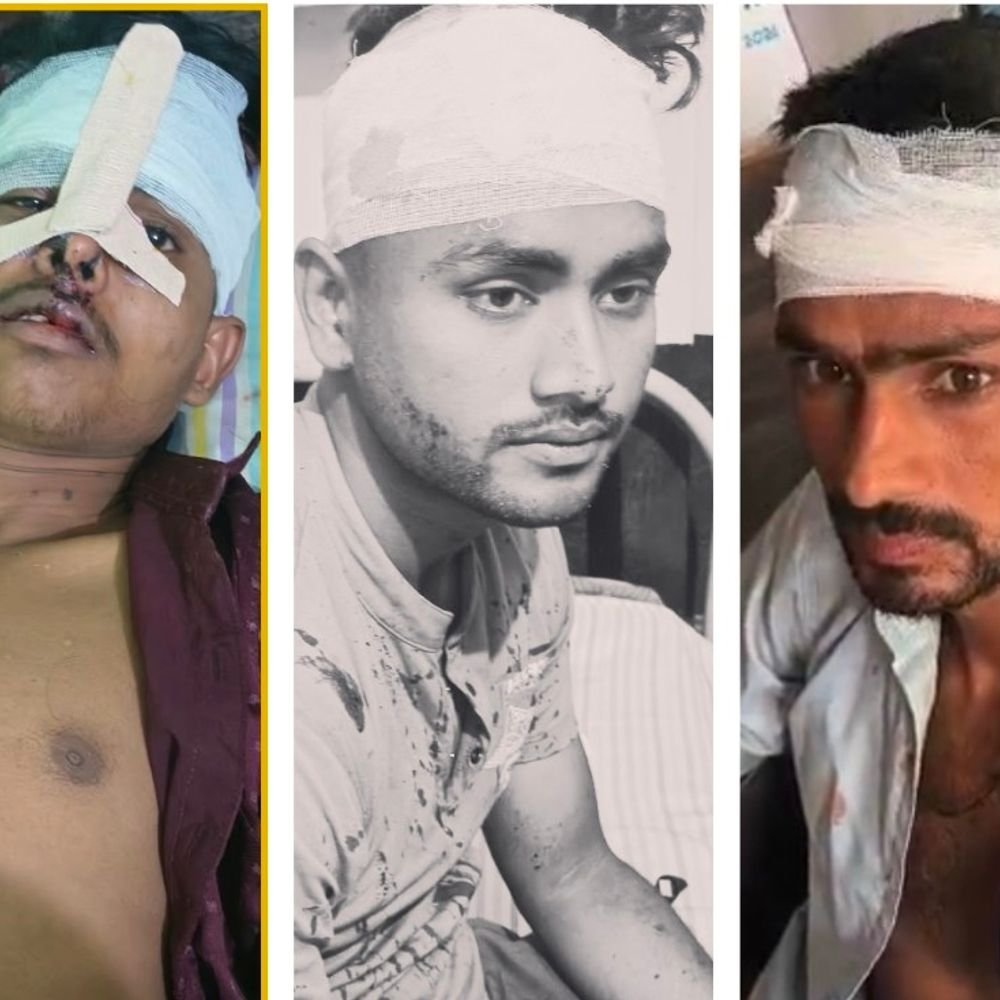 कौशांबी में युवक के सीने पर तमंचा सटाकर रंगदारी वसूली:परिजनों पर लाठी-डंडों से हमला, 3 घायल; QR कोड से मंगवाए थे रुपए