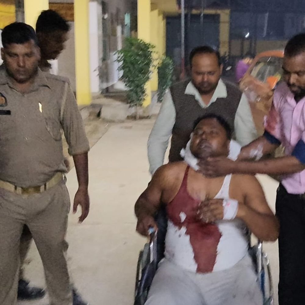 वाराणसी में डॉक्टर के भाई पर जानलेवा हमला:धारदार हथियार से गर्दन पर वार, 15 टांके लगे; आधी रात कमरे में घुसे दो लोग