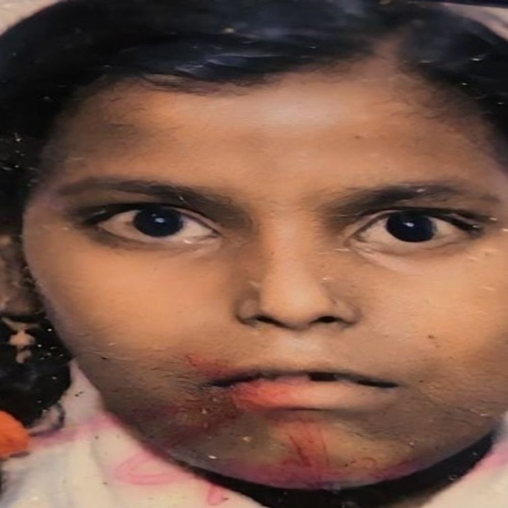 बाइक की टक्कर से घायल छात्रा की मौत:शाहजहांपुर में इलाज के दौरान तोड़ा दम, कक्षा 8 में पढ़ती थी