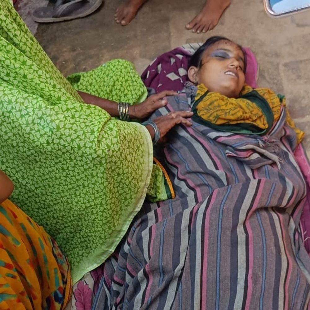 आगरा में पत्नी की रस्सी से गला घोंटकर हत्या:शराब पीकर रोज करता था मारपीट, 14 साल पहले हुई थी शादी, आरोपी मौके से फरार