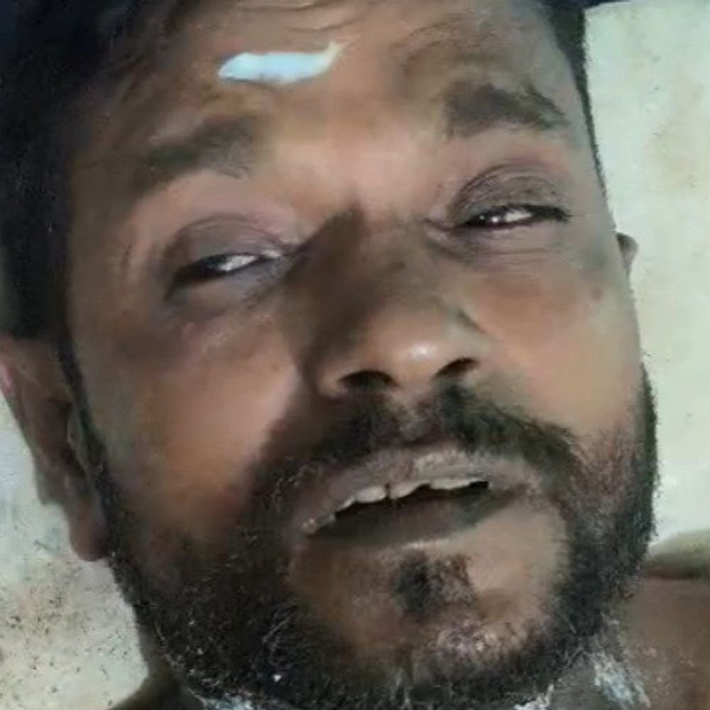 जौनपुर में किसान ने खुद को आग लगाई:जमीन पर रास्ता बनाने को लेकर विवाद, पुलिस पर लगाए आरोप; पुलिस बोली- रुकवा दिया था निर्माण