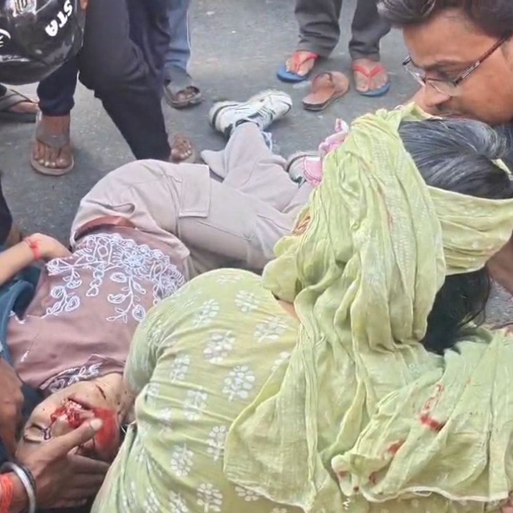 उन्नाव में लोडर की टक्कर से किशोरी की मौत:मां भी घायल, ऑटो से उतरते समय लोडर ने मारी टक्कर, दवा लेने निकले थे