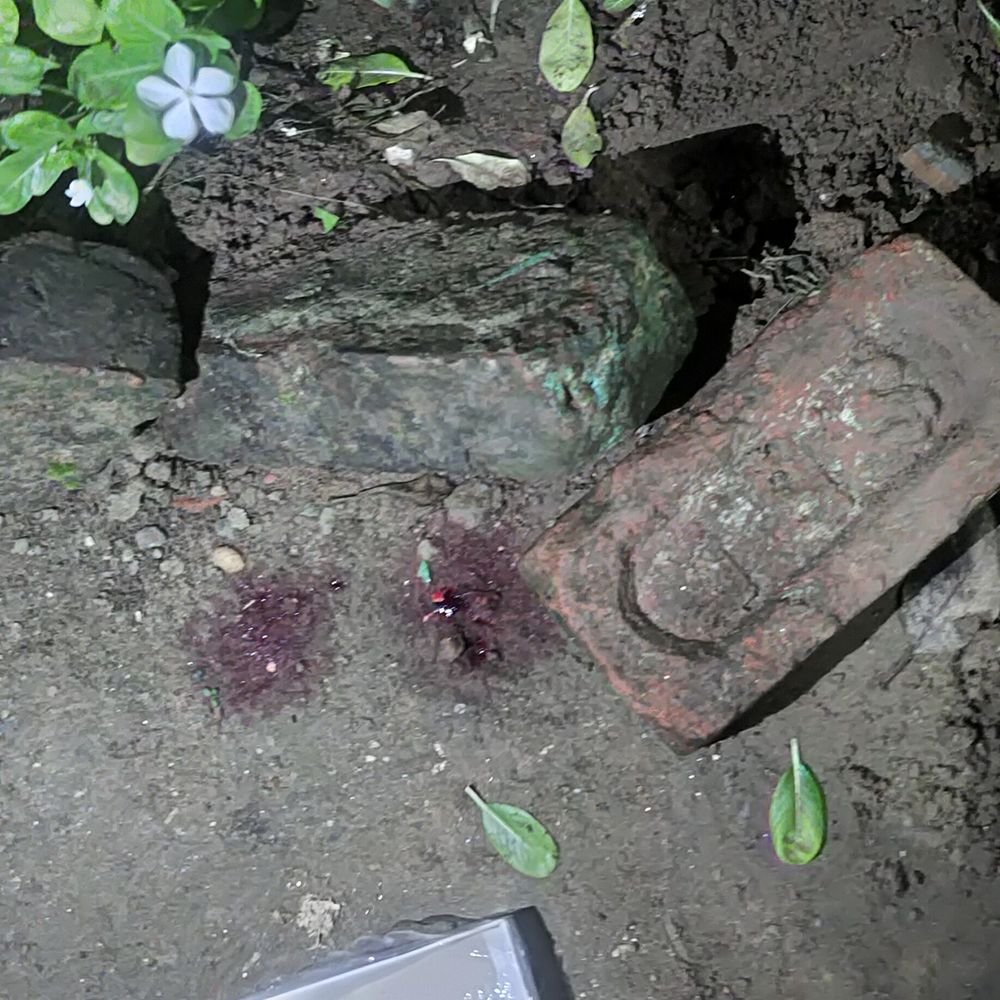 मेडिकल वार्ड की खिड़की से गिरा मरीज, मौत:दूसरी मंजिल की खिड़की से गिरा 60 साल का मरीज, ट्रॉमा सेंटर में इलाज के दौरान मौत
