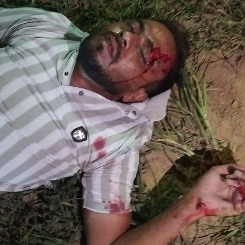 NH-9 पर अज्ञात कार ने बाइक सवार को टक्कर मारी:हापुड़ के शहजाद गंभीर घायल, जिला अस्पताल में इलाज जारी; पुलिस जांच में जुटी