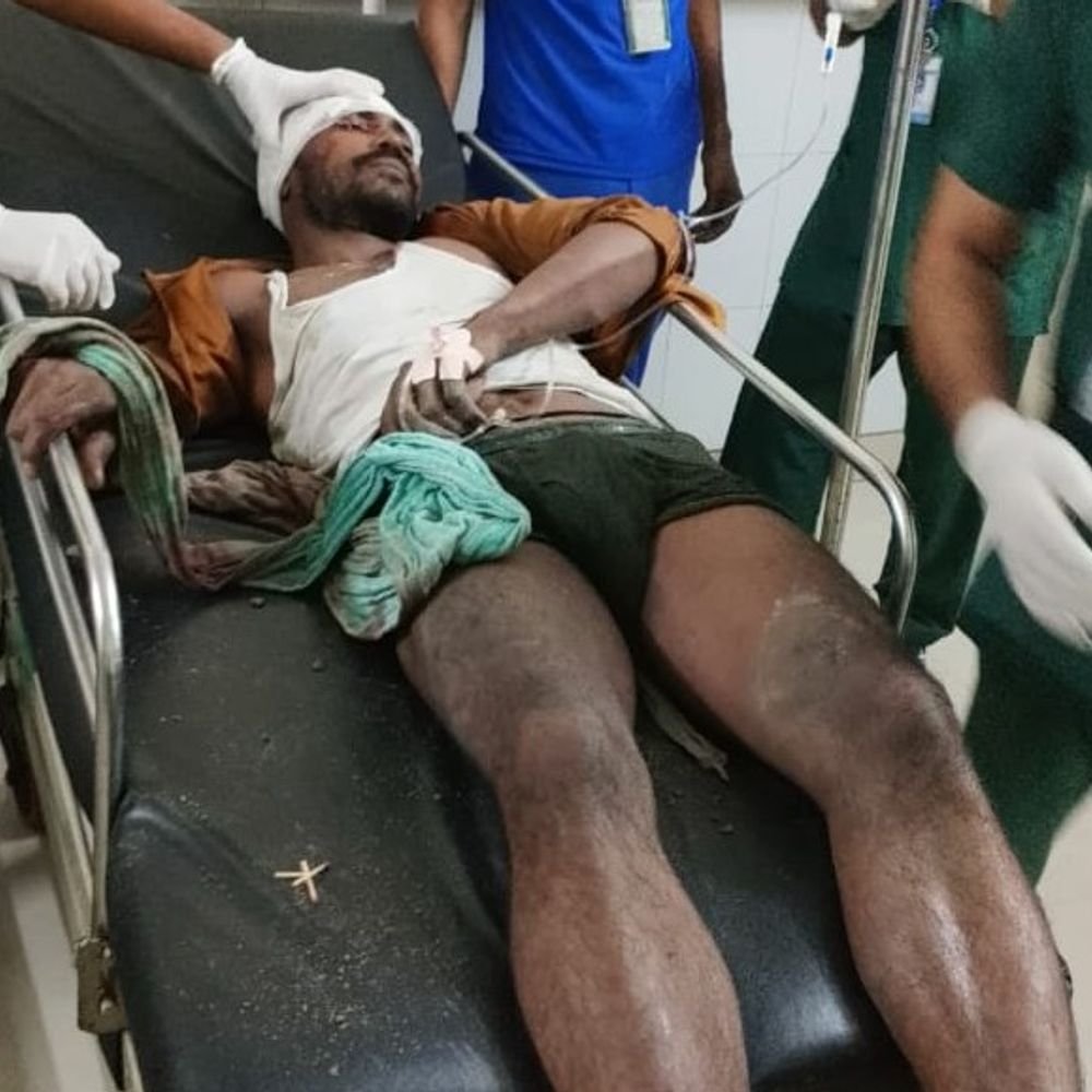 निर्माणाधीन लिंटर गिरने में पुलिस ने दर्ज की FIR:गाजियाबाद के साहिबाबाद में मलबे दबने से घायलों की हालत में सुधार
