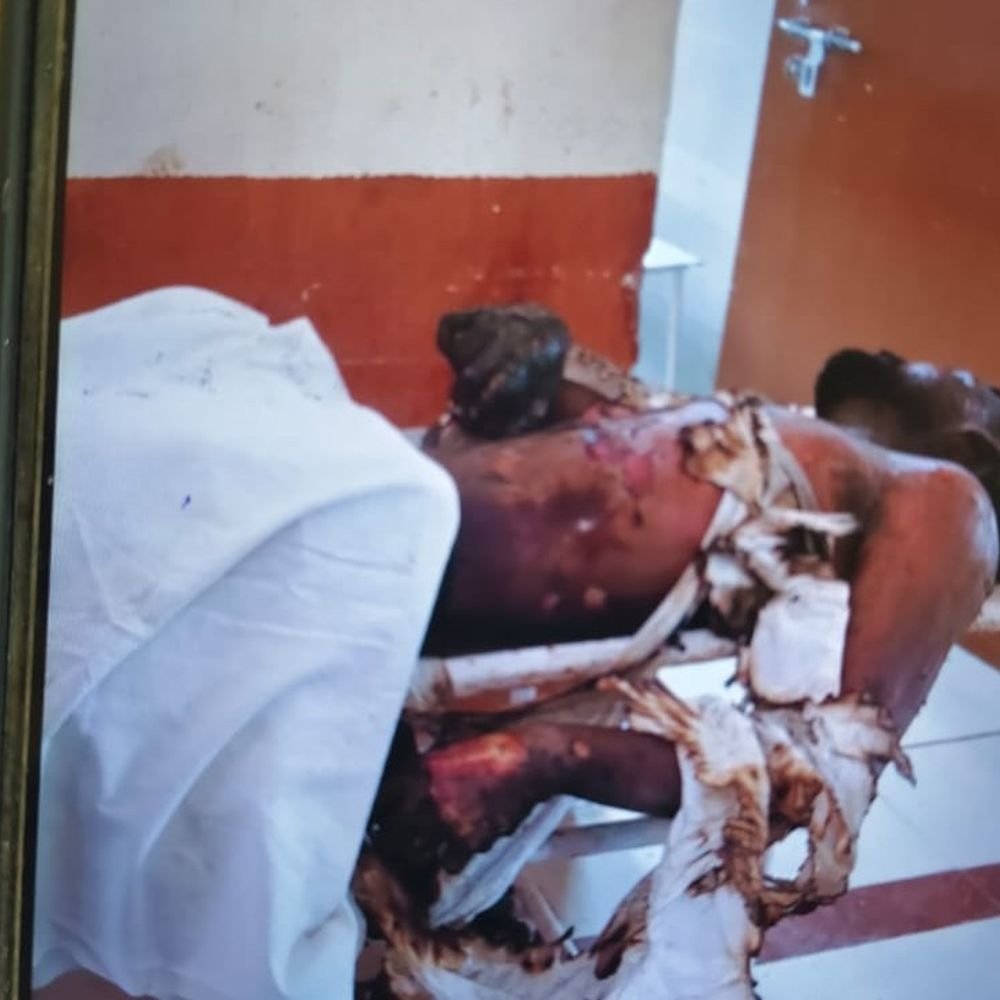 लाइन चालू करते समय संविदा लाइनमैन की करंट से मौत:उन्नाव में बिजली विभाग पर लपरवाही का आरोप, 7 साल पहले हुई थी भर्ती