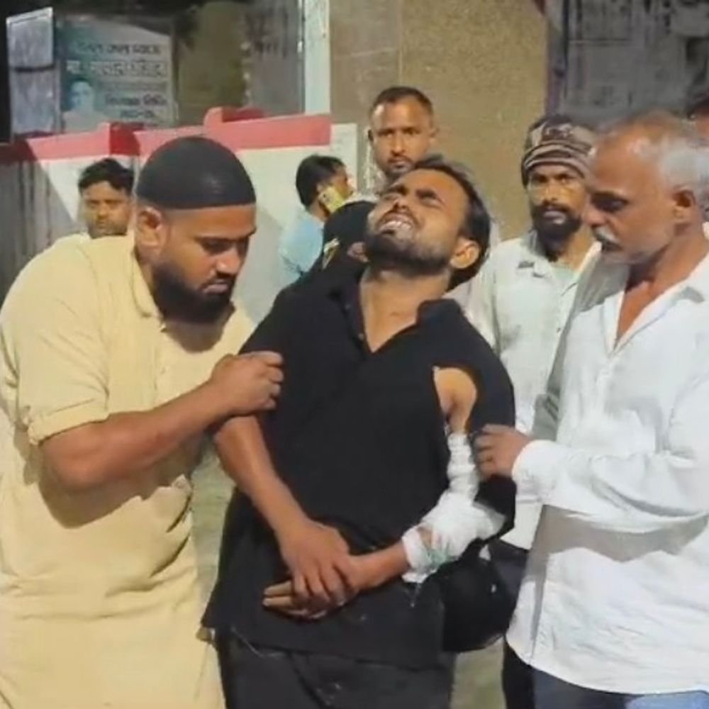 मुरादाबाद मेले में कीचड़ विवाद पर युवक को गोली मारी:हालत गंभीर होने पर हायर सेंटर रेफर, 3 नामजद आरोपियों पर केस दर्ज