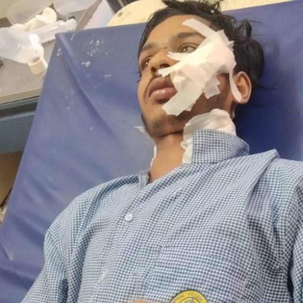 प्रतिमा विसर्जन में चाकू-भुजाली से हमला करने वालों पर FIR:डांस करने पर विवाद हुआ, घायल को लगे 32 टांके