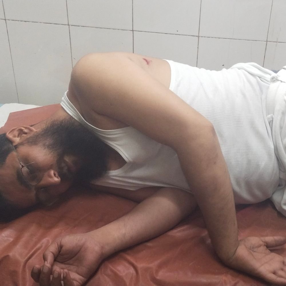 ललितपुर में मीडियाकर्मी पर लोहे की रॉड से हमला:रंगदारी मांगने और हर हफ्ते रुपए देने का आरोप, मेडिकल कॉलेज में भर्ती