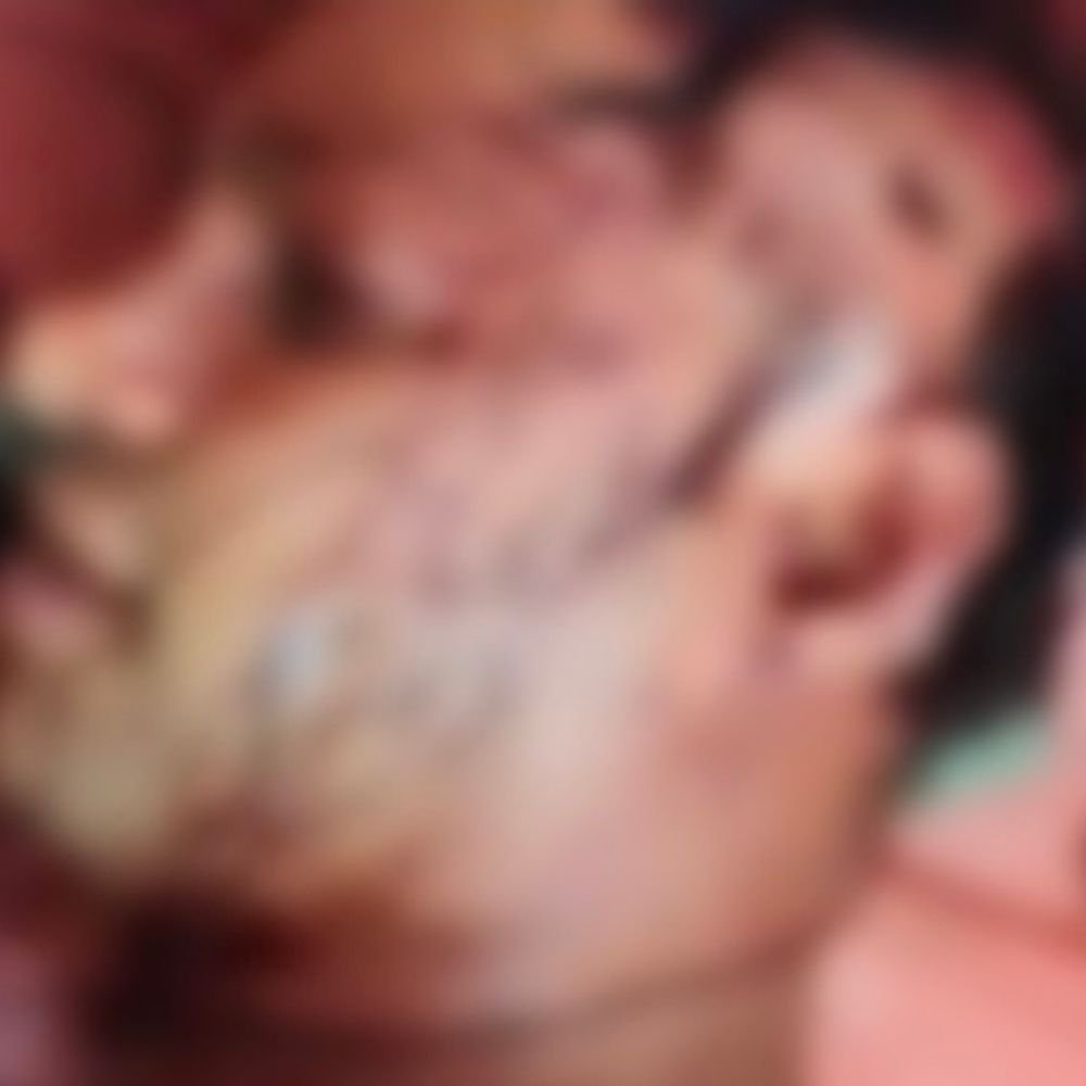 बच्चों को टहला रहे नारियल विक्रेता पर हमला:सहारनपुर में दो युवकों ने सिर-गर्दन पर रॉड और सरिये से वार किए