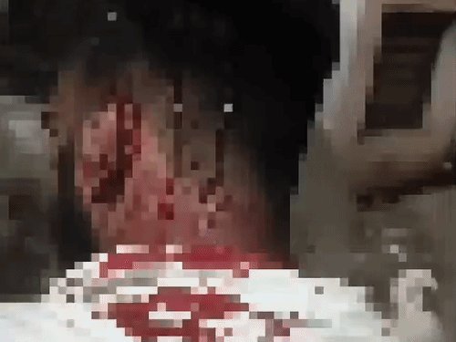 कोल्डड्रिंक का बिल न देने पर युवक का सिर फोड़ा:धारदार कड़ें और ईटों से किया हमला, गोविंद नगर में 4 के खिलाफ FIR