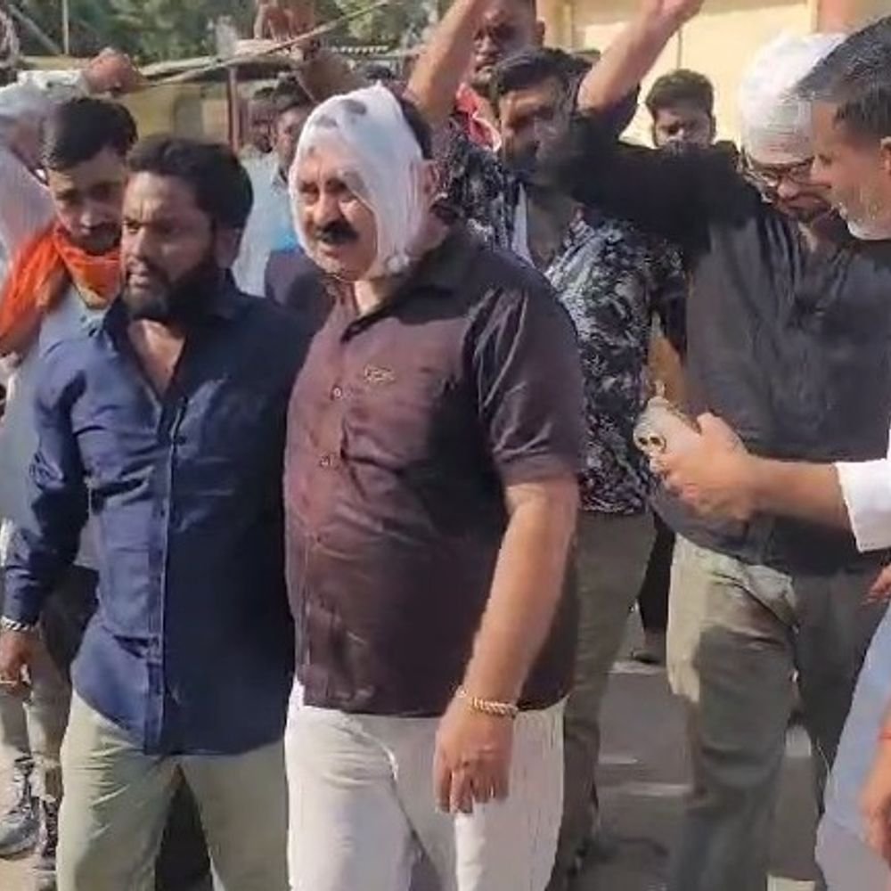 उन्नाव में कपड़ा व्यापारी और बेटों पर दबंगों का हमला:AC के पानी को लेकर विवाद; तीन घायल, गिरफ्तारी के आश्वासन पर शांत हुए व्यापारी