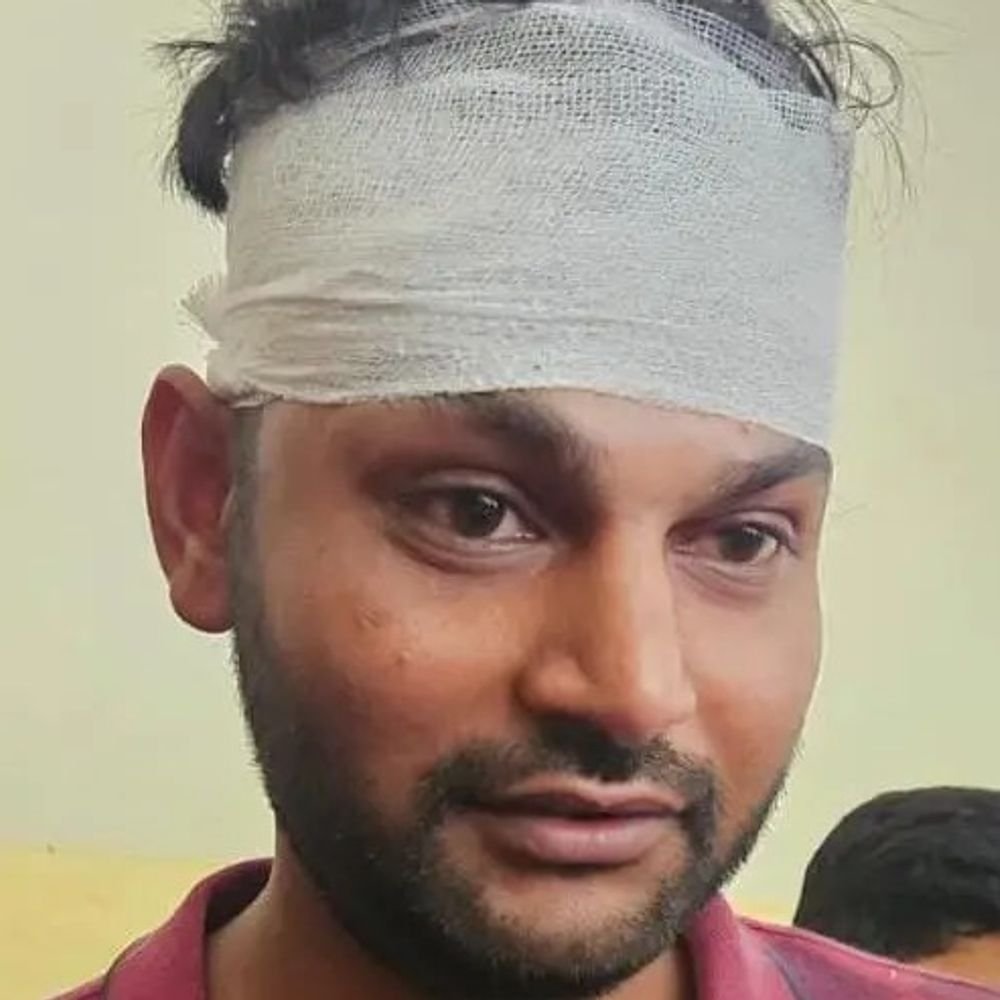 अनपरा में जेई संगठन अध्यक्ष पर बैट से हमला:क्लब में महिला के साथ युवक को देखकर आपत्ति जताई थी, सिर में लगे चार टांके