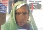 एटा में स्कूल की सफाई करते वक्त महिला को पीटा:गांव के आधा दर्जन लोगों ने लात-घूसों से मारा, जातिसूचक गालियां भी दीं; SSP से शिकायत
