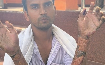 मैनपुरी में युवक पर तारपीन डालकर आग लगाई, झुलसा:गंभीर हालत में अस्पताल में भर्ती कराया, पुलिस ने केस दर्ज कर जांच शुरू की