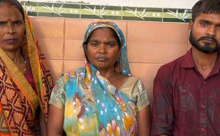 रामपुर में महिला ने खुद को आग लगाई:90 फीसदी झुलसी, पति बोला- घर में डीजल छिड़ककर खुद को जलाया